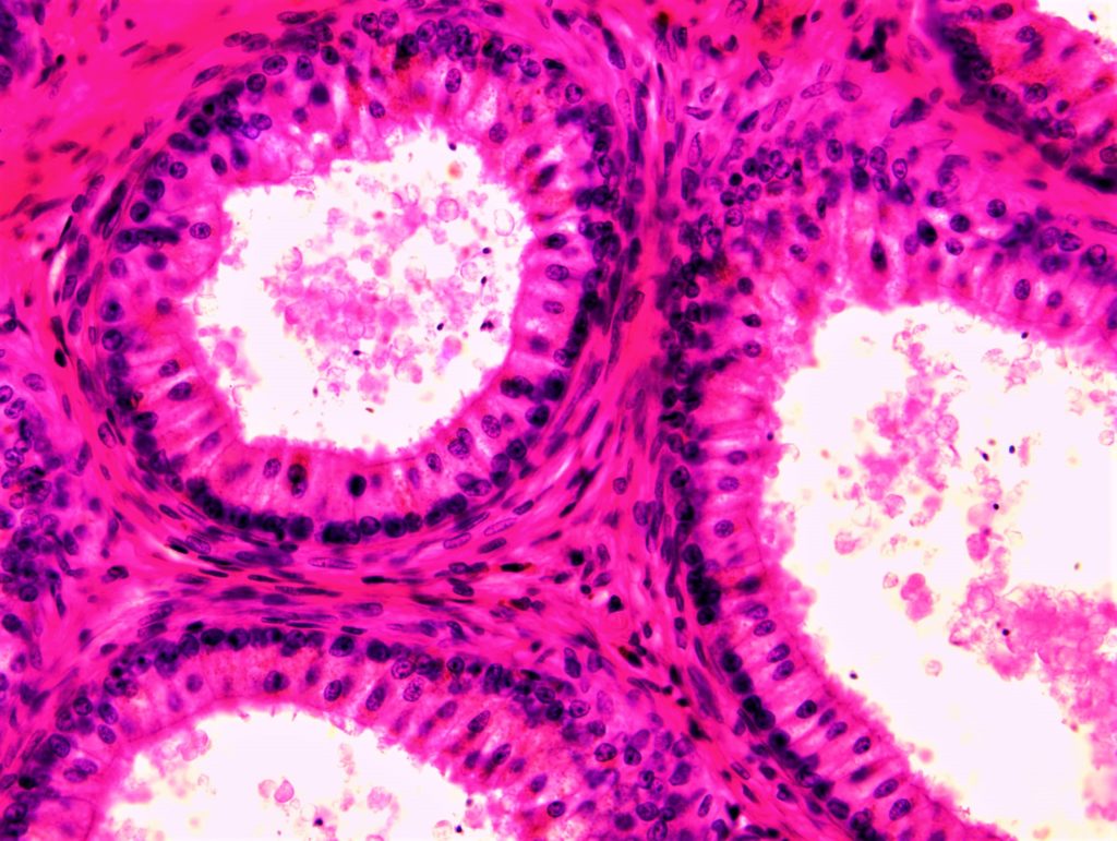 Testis I Epididimis Histoloski Atlas