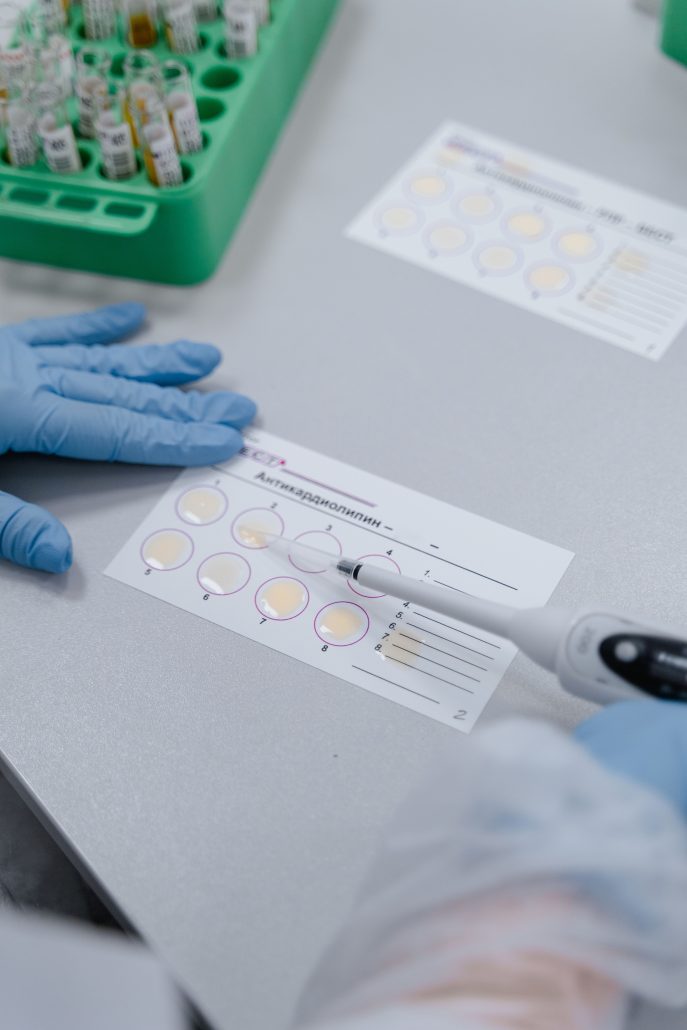 Close-up of a scientist using pipette on sample cards in the lab.
